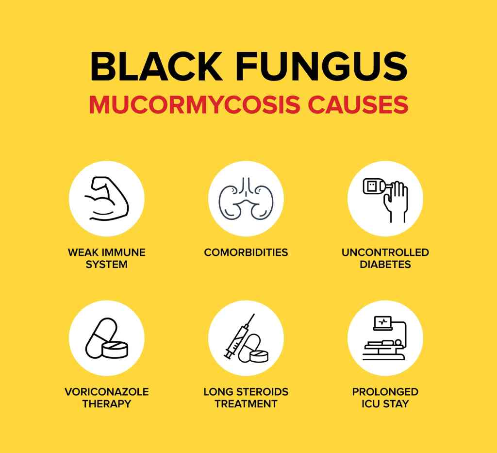 Black Fungus Mucormycosis Causes