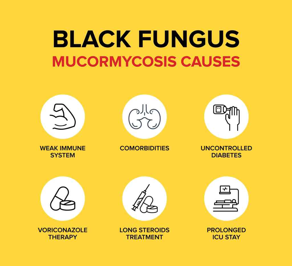 'Black Fungus' Infection, Causes, Symptoms & Treatment Ketto