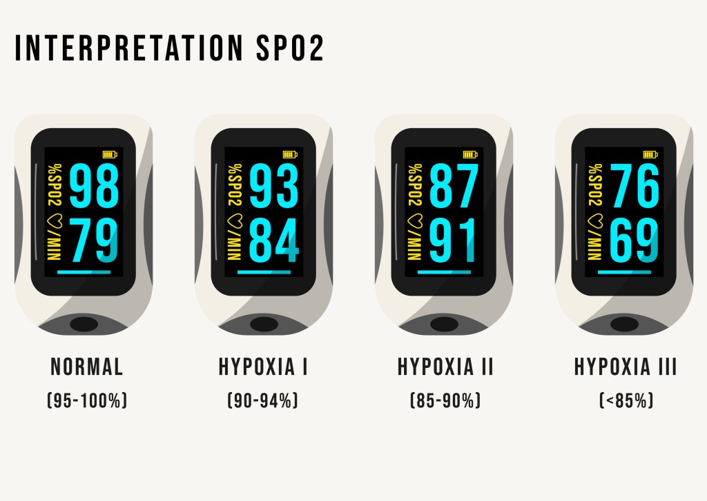 SPO2 INTERPRETATION